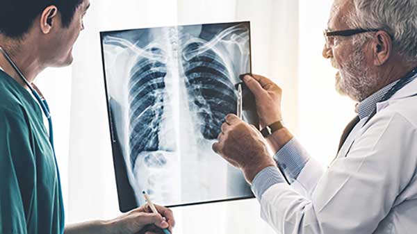 doctors reviewing xray